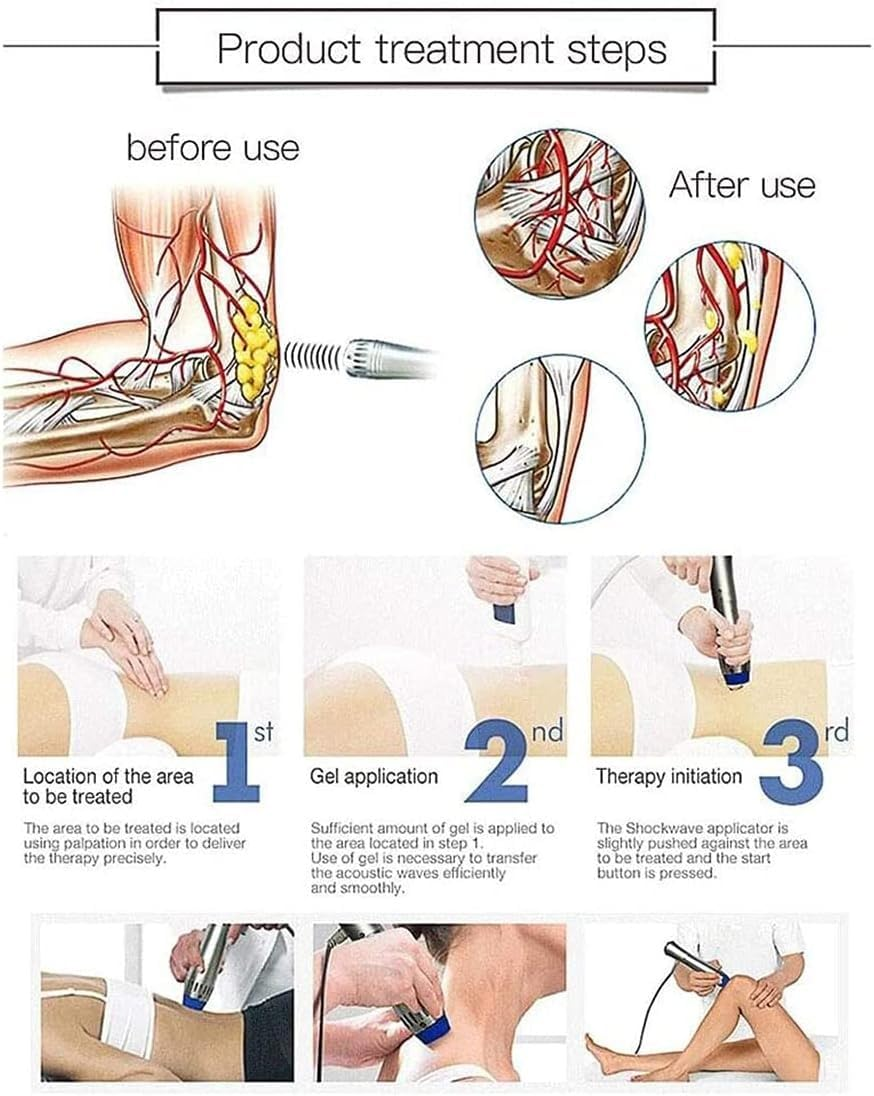 ED Shockwave Therapy Device, Electromagnetic Extracorporeal Shockwave Therapy Device Used for Body Percussion, Muscle Relaxation and Pain Relief - Image 10